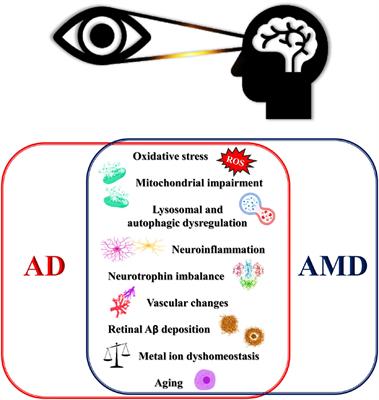 Nerve Growth Factor-Based Therapy in Alzheimer’s Disease and Age-Related Macular Degeneration